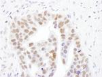 NMNAT1 Antibody in Immunohistochemistry (IHC)