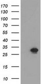 NMNAT1 Antibody in Western Blot (WB)