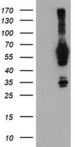 NMT2 Antibody in Western Blot (WB)