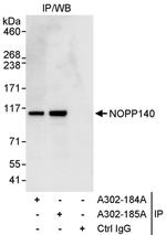 NOPP140 Antibody in Immunoprecipitation (IP)
