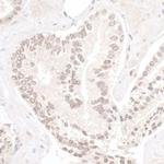 NP95/UHRF1 Antibody in Immunohistochemistry (IHC)