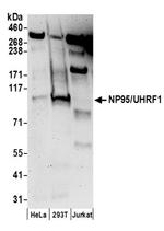 NP95/UHRF1 Antibody in Western Blot (WB)