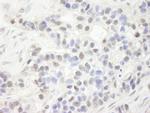 NP95/UHRF1 Antibody in Immunohistochemistry (IHC)