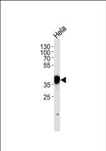 NPM1 Antibody in Western Blot (WB)