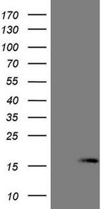 NPPB Antibody in Western Blot (WB)