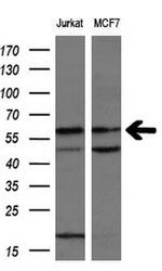 NPR3 Antibody in Western Blot (WB)