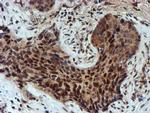 NQO2 Antibody in Immunohistochemistry (Paraffin) (IHC (P))