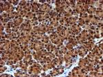 NQO2 Antibody in Immunohistochemistry (Paraffin) (IHC (P))