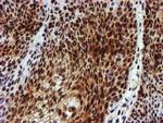 NQO2 Antibody in Immunohistochemistry (Paraffin) (IHC (P))