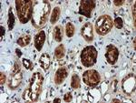 NQO2 Antibody in Immunohistochemistry (Paraffin) (IHC (P))