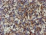 NQO2 Antibody in Immunohistochemistry (Paraffin) (IHC (P))