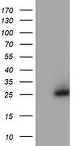 NQO2 Antibody in Western Blot (WB)