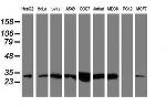 NQO2 Antibody in Western Blot (WB)