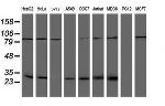 NQO2 Antibody in Western Blot (WB)