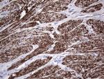 NR1I3 Antibody in Immunohistochemistry (Paraffin) (IHC (P))