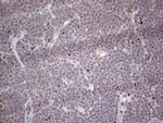 NR1I3 Antibody in Immunohistochemistry (Paraffin) (IHC (P))