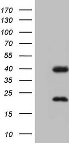 NR1I3 Antibody in Western Blot (WB)