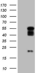 NR2E3 Antibody in Western Blot (WB)