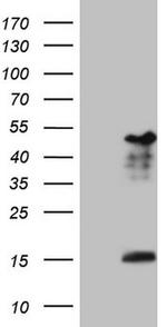 NR2E3 Antibody in Western Blot (WB)