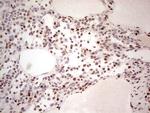 NR3C1 Antibody in Immunohistochemistry (Paraffin) (IHC (P))