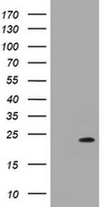 NRAS Antibody in Western Blot (WB)