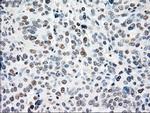 NRBP1 Antibody in Immunohistochemistry (Paraffin) (IHC (P))