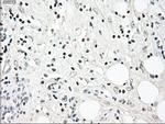 NRBP1 Antibody in Immunohistochemistry (Paraffin) (IHC (P))