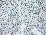 NRBP1 Antibody in Immunohistochemistry (Paraffin) (IHC (P))