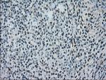 NRBP1 Antibody in Immunohistochemistry (Paraffin) (IHC (P))