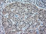 NRBP1 Antibody in Immunohistochemistry (Paraffin) (IHC (P))