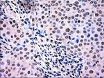 NRBP1 Antibody in Immunohistochemistry (Paraffin) (IHC (P))