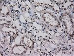 NRBP1 Antibody in Immunohistochemistry (Paraffin) (IHC (P))