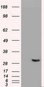 NT3 Antibody in Western Blot (WB)