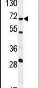 NT5C1B Antibody in Western Blot (WB)