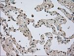 NTRK3 Antibody in Immunohistochemistry (Paraffin) (IHC (P))