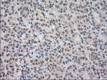 NTRK3 Antibody in Immunohistochemistry (Paraffin) (IHC (P))