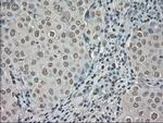 NTRK3 Antibody in Immunohistochemistry (Paraffin) (IHC (P))