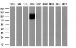 NTRK3 Antibody in Western Blot (WB)