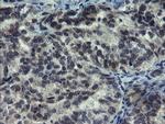 NUB1 Antibody in Immunohistochemistry (Paraffin) (IHC (P))