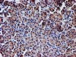 NUBPL Antibody in Immunohistochemistry (Paraffin) (IHC (P))