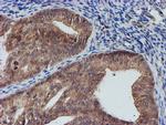 NUBPL Antibody in Immunohistochemistry (Paraffin) (IHC (P))