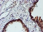 NUBPL Antibody in Immunohistochemistry (Paraffin) (IHC (P))