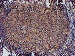 NUBPL Antibody in Immunohistochemistry (Paraffin) (IHC (P))