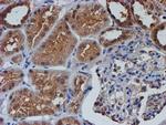 NUBPL Antibody in Immunohistochemistry (Paraffin) (IHC (P))