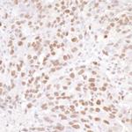 NUCKS Antibody in Immunohistochemistry (IHC)