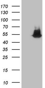 NUDT12 Antibody in Western Blot (WB)