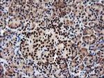 NUDT18 Antibody in Immunohistochemistry (Paraffin) (IHC (P))