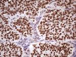 NUDT21 Antibody in Immunohistochemistry (Paraffin) (IHC (P))