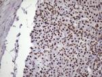 NUDT21 Antibody in Immunohistochemistry (Paraffin) (IHC (P))