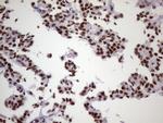 NUDT21 Antibody in Immunohistochemistry (Paraffin) (IHC (P))